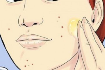 男生祛痘印面膜有哪些效果比较好的？