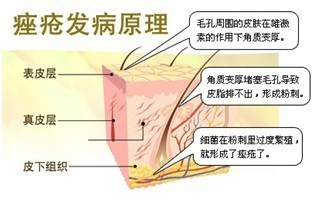 嘴巴周围长痘痘怎么调理图片