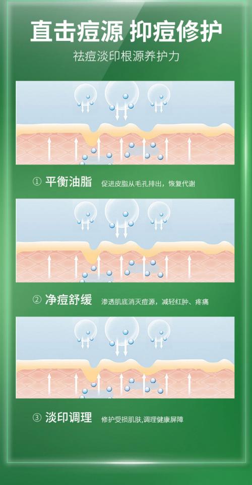 痘痘怎么样祛除,痘痘怎么样修复