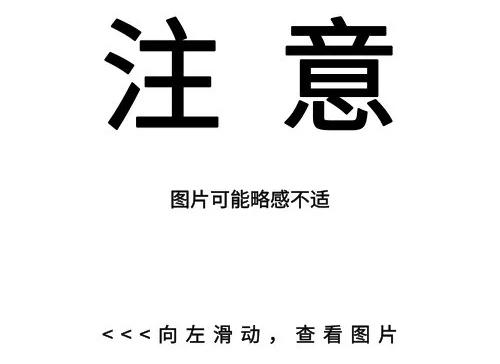 激光治疗痘痘怎么样,为什么会突然长很多痘痘