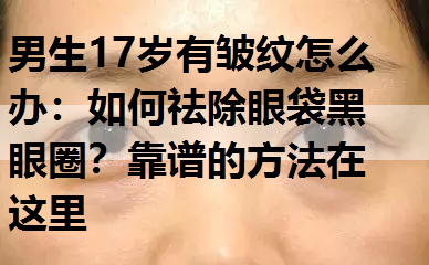 如何祛除眼袋黑眼圈？靠谱的方法在这里