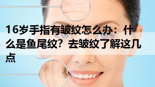 6岁手指有皱纹怎么办：什么是鱼尾纹？去皱纹了解这几点"